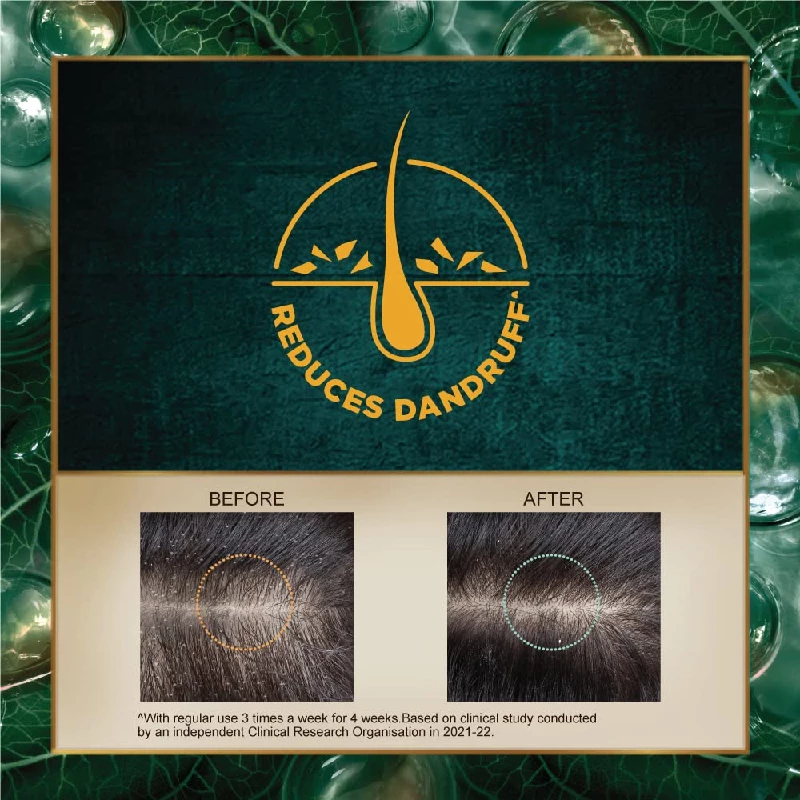 Indulekha Dandruff Treatment Shampoo, 200 ml-3.webp